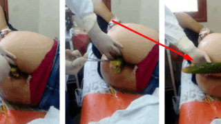 Doctor le saco de emergencia un pepino